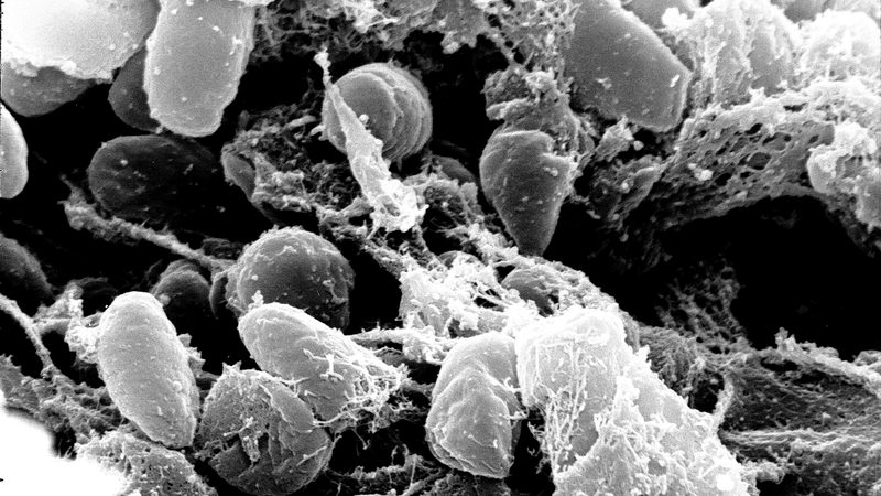 Electron micrograph of Yersinia pestis bacteria, in black and white